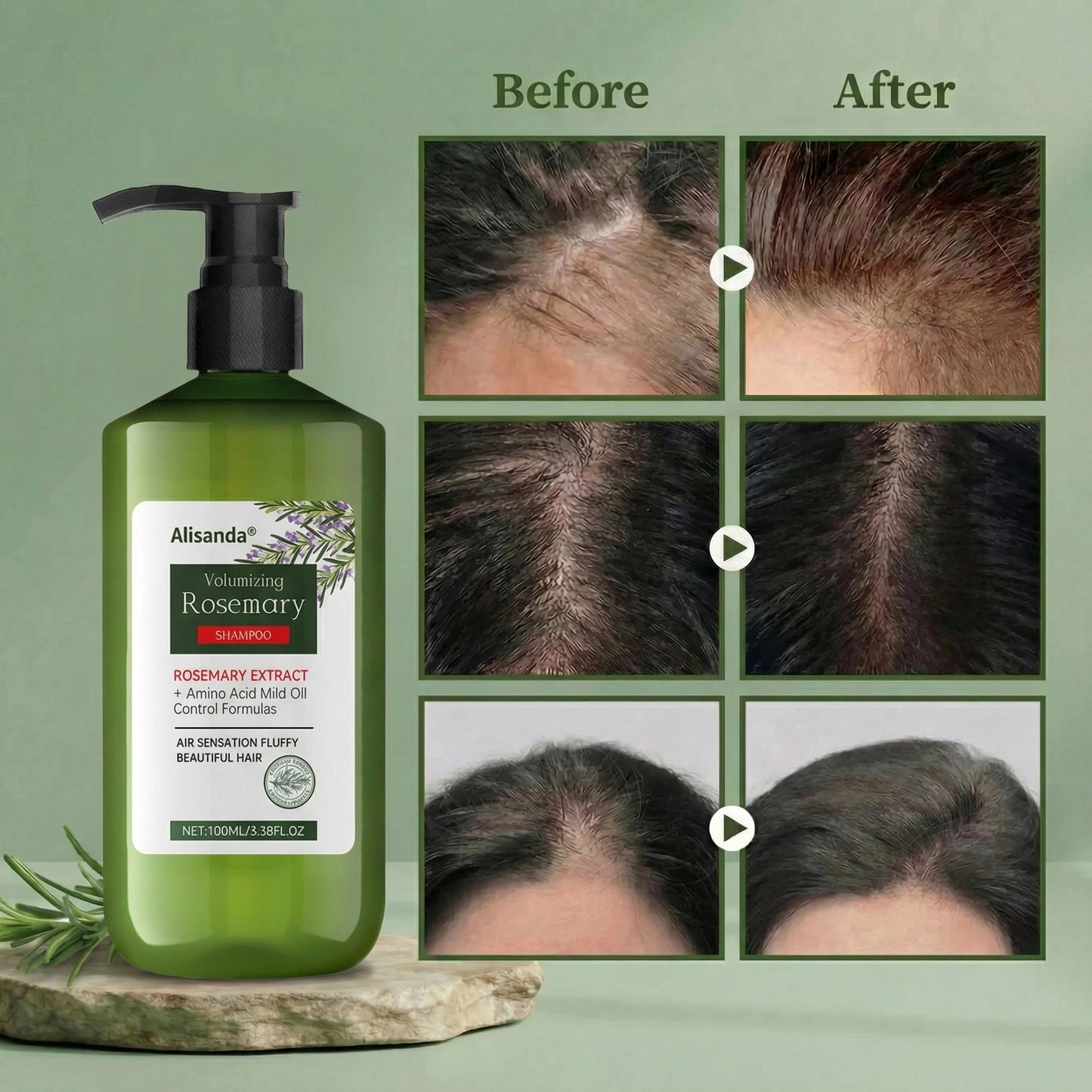 š„LAST DAY 60% OFFš„AlisandaĀ® Rosemary Volumizing Shampoo