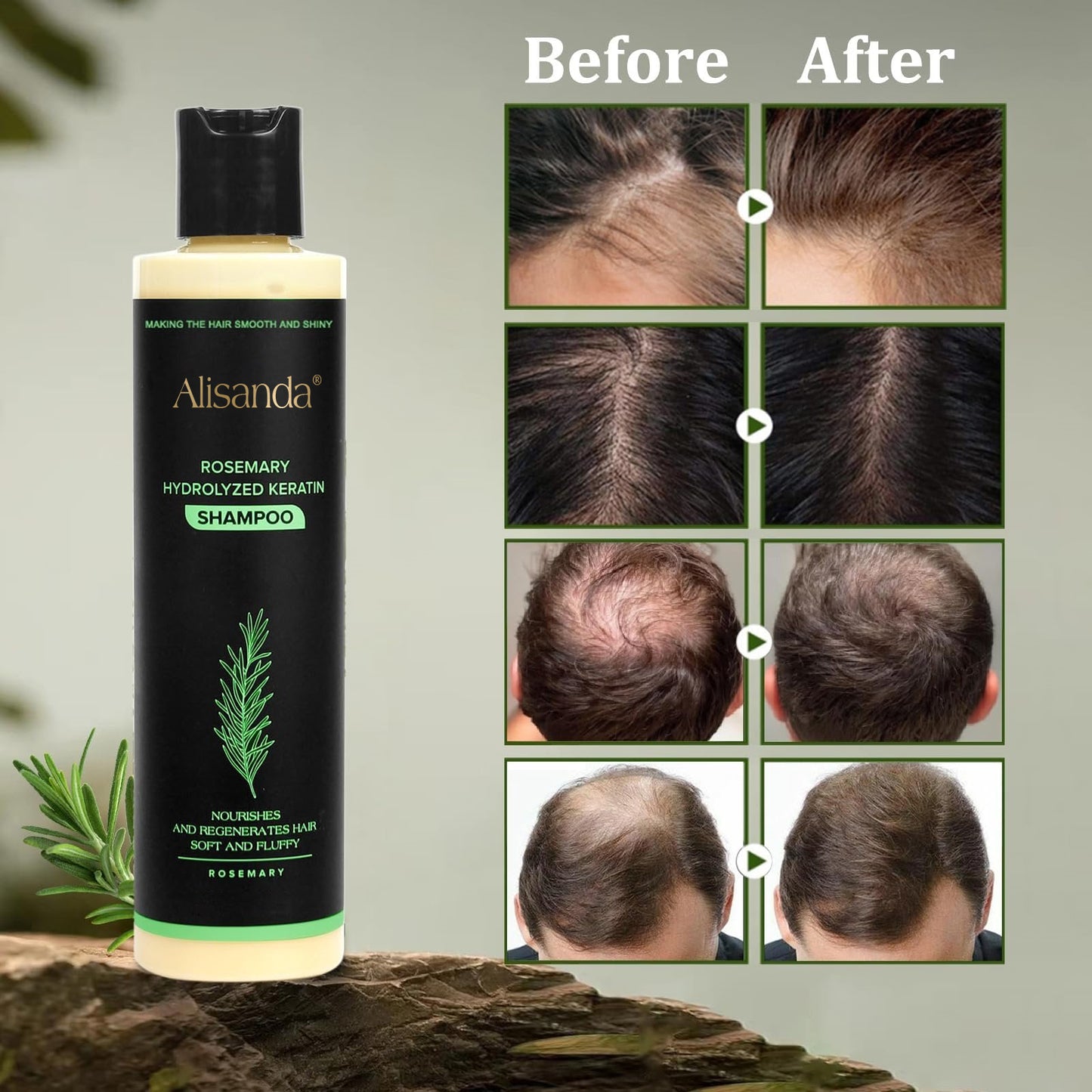 š„LAST DAY 50% OFF - š
AlisandaĀ® Organic Rosemary Hair Growth Shampoo