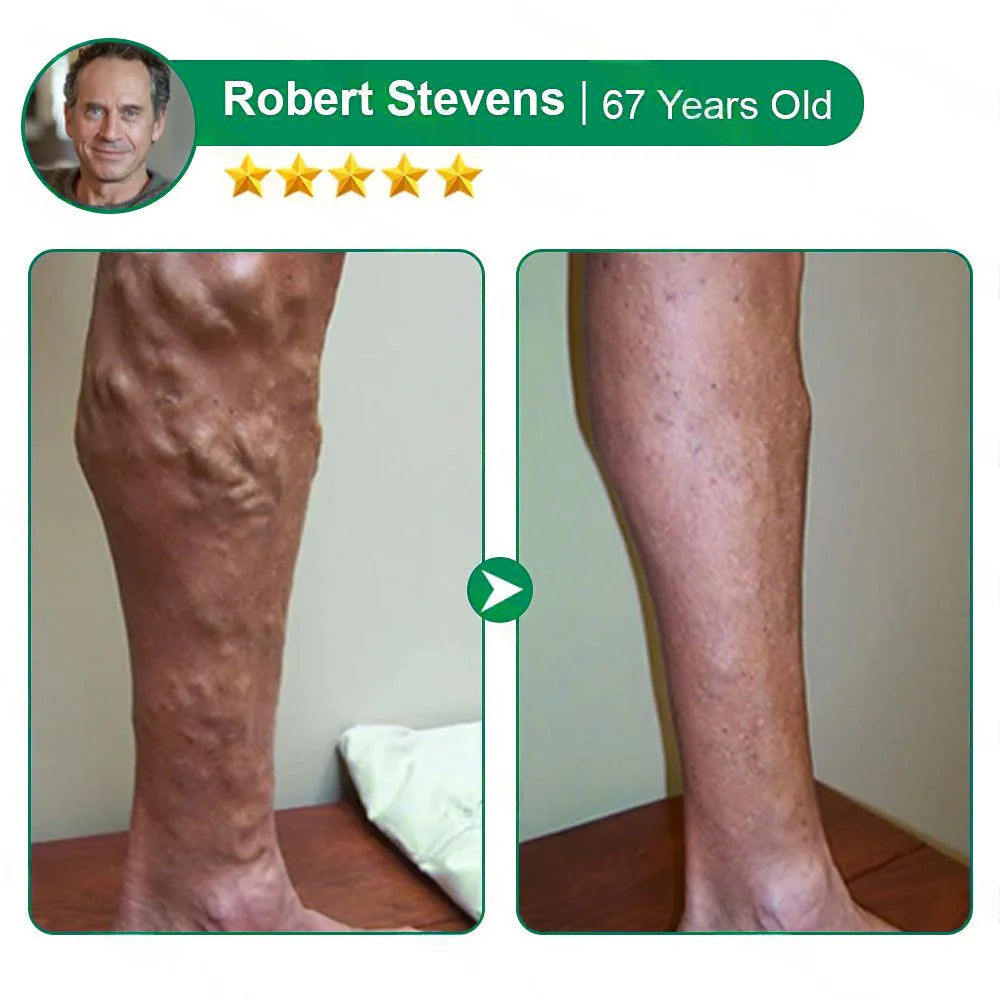 š§AlisandaĀ® VeinTarget Microneedle Patchā”Instant Relief, Long-Term Results