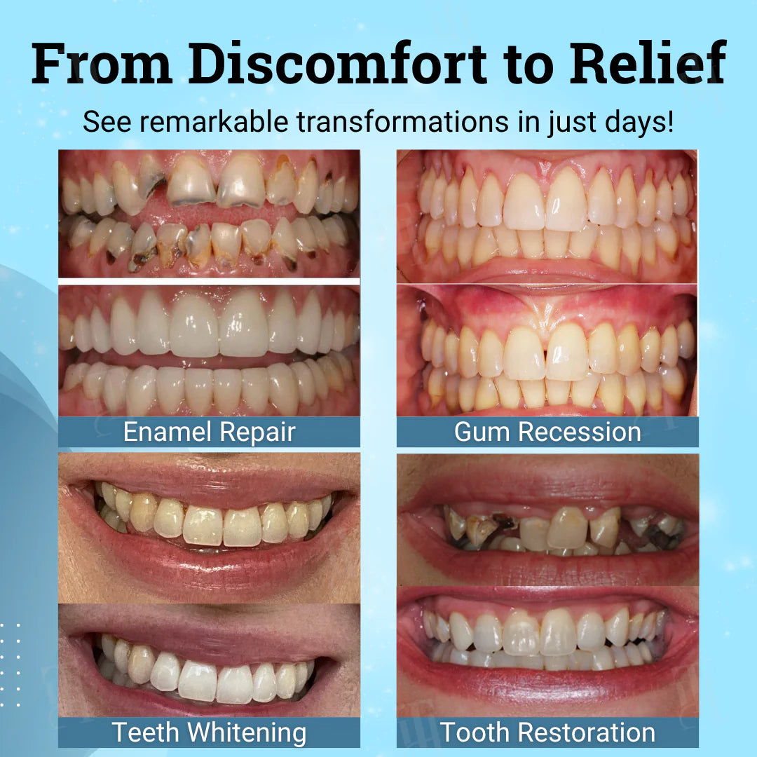 šØāāļø Dentist's Choice : AlisandaĀ® Non-Surgical Gum "Suture" Gel