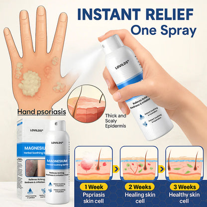 LOVILDS® Magnesium Herbal Psoriasis Spray