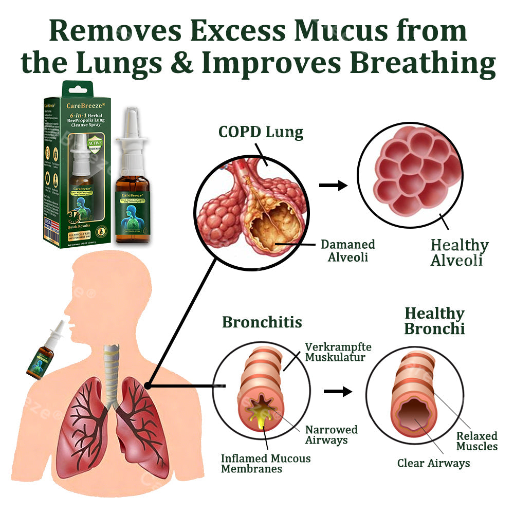 Alisanda® 6-in-1 Herbal BeePropolis Lung Cleanse Spray(⚡Fast Relief 🫁Long-Lasting Benefits)