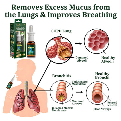 Alisanda® 6-in-1 Herbal BeePropolis Lung Cleanse Spray(⚡Fast Relief 🫁Long-Lasting Benefits)