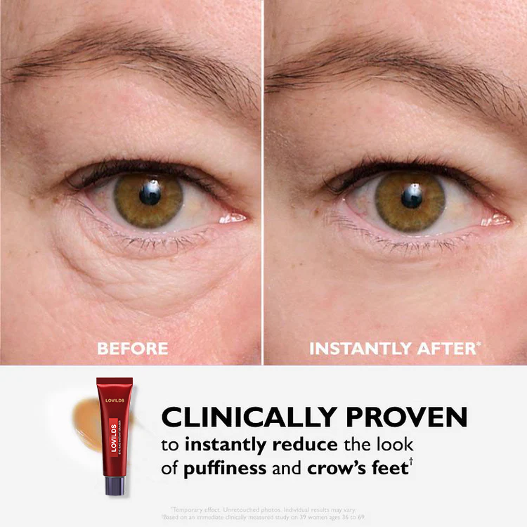 🔥 Last 3 Hours 50% OFF 🔥Eye Bag Eraser — Instantly Refreshes, Firms & Smooths for a Youthful Look That Lasts 8 Hours