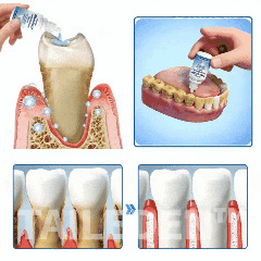 TAILEDEN™ Tooth Defense Serum