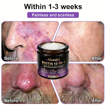 ✨Alisanda® Biotin 10-in-1 Skin Restoration Cream 🌙