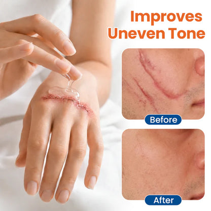Alisanda® Dermal Rebuild Skin Repair & Restore Gel