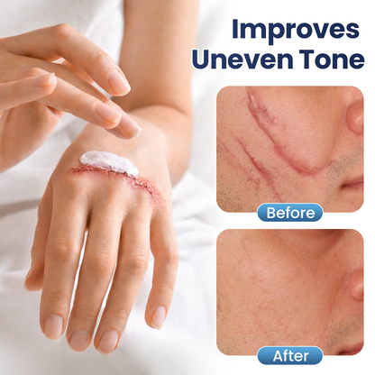 💥50% OFF💥Alisanda® Texture Repair Gel