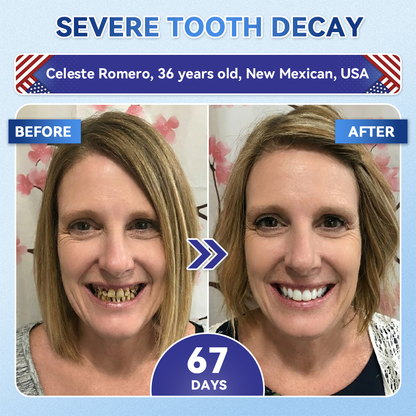 Alisanda® 🦷 Tideglusib Fast‑Dissolving Tooth & Gum Repair Oral Strips ✨