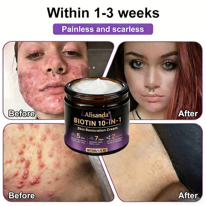 ✨Alisanda® Biotin 10-in-1 Skin Restoration Cream 🌙