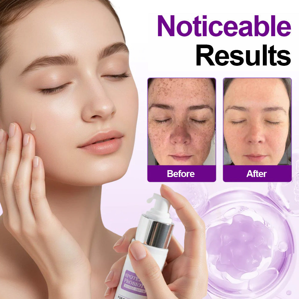 Alisanda® SpotErase Probiotic Shield Serum 27 2 d392f38e 411f 4a59 bff4 1fce45fd6627