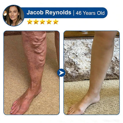 🇺🇸👨‍⚕️✅TAILEDEN® 𝑽𝗲𝗶𝙣 𝘾𝐨𝐧𝘁𝗼𝙪𝙧 𝙈𝙞𝐜𝐫𝒐𝒏𝒆𝗲𝗱𝗹𝙚 𝙋𝙖𝐭𝐜𝒉 𝒘𝒊𝘁𝗵 𝗔𝙙𝙫𝙖𝙣𝙘𝐞𝐝 𝐃𝒊𝒐𝒔𝗺𝙞𝐧 & 𝑯𝒆𝘀𝗽𝗲𝙧𝙞𝙙𝙞𝐧 𝐃𝒆𝒍𝒊𝒗𝗲𝗿𝙮🌿𝟕-𝐃𝐚𝐲 𝐕𝐢𝐬𝐢𝐛𝐥𝐞 𝐑𝐞𝐬𝐮𝐥𝐭𝐬 𝐟𝐨𝐫 𝐕𝐚𝐫𝐢𝐜𝐨𝐬𝐞 𝐕𝐞𝐢𝐧𝐬