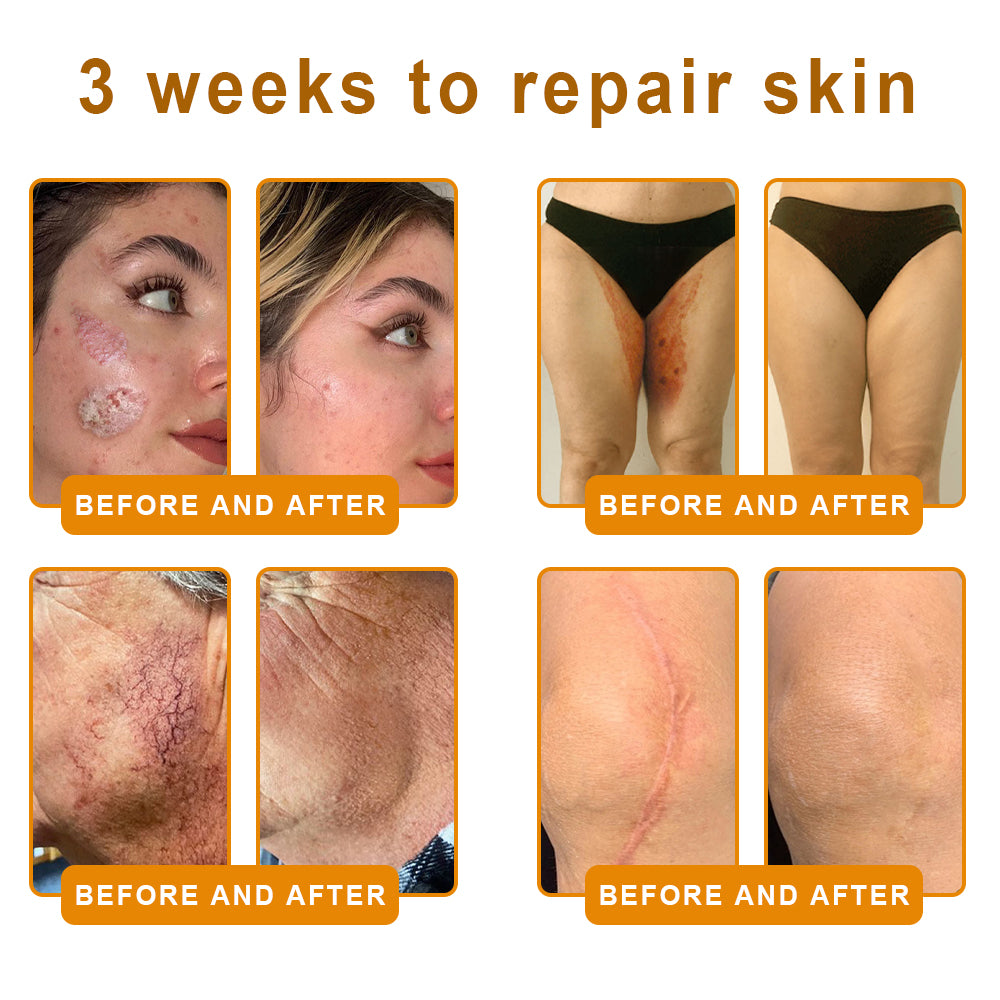✨LOVILDS™  Bee Venom Skin Restoration Cream — 🔥Limited Time 60% OFF🔥