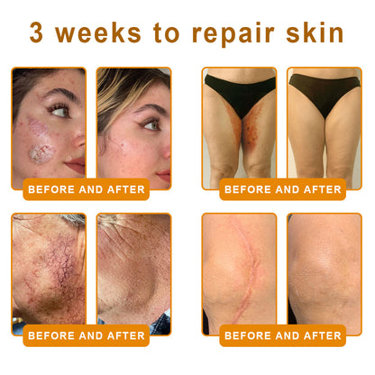 ✨LOVILDS™  Bee Venom Skin Restoration Cream — 🔥Limited Time 60% OFF🔥