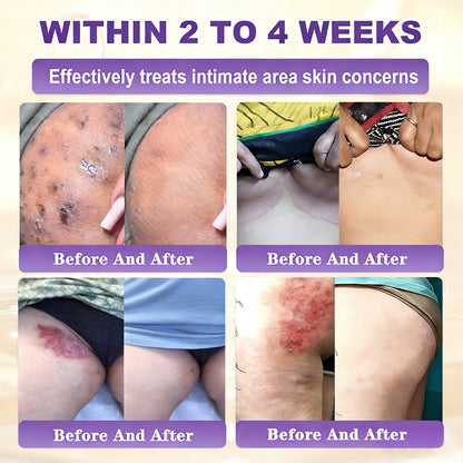 ✨Alisanda® Biotin 10-in-1 Skin Restoration Cream 🌙