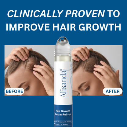 Alisanda® Hair Growth Roll on Serum