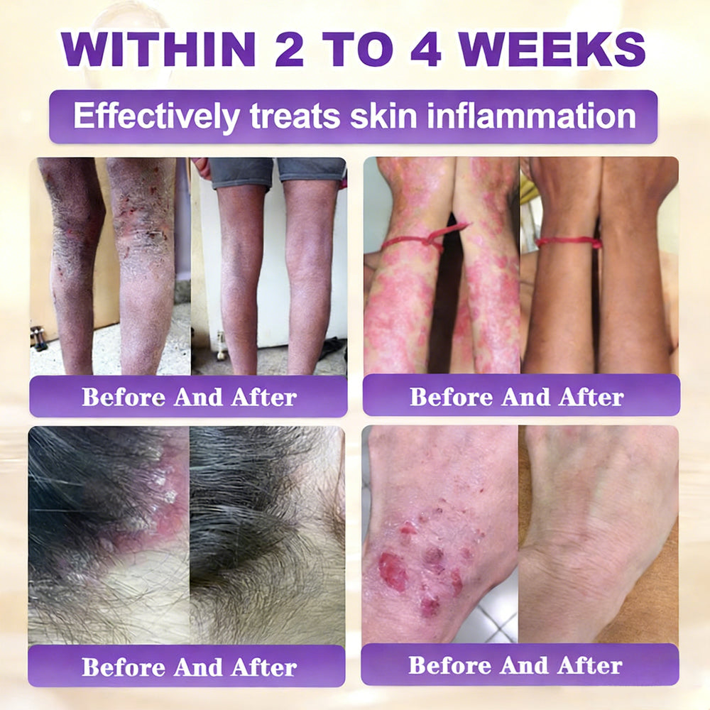 ✨Alisanda® Biotin 10-in-1 Skin Restoration Cream 🌙