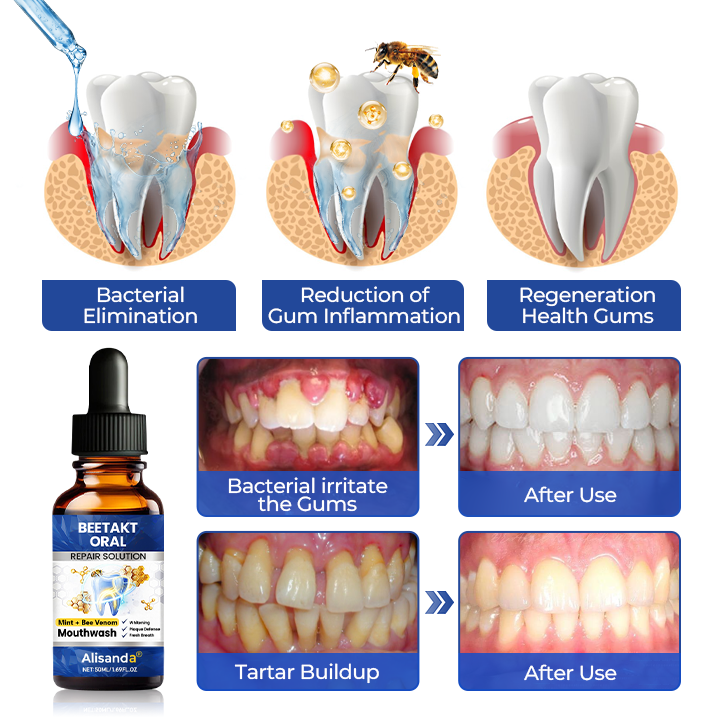 Alisanda® Oral Repair Solution