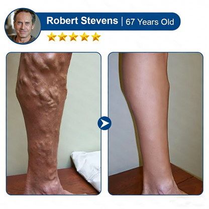 🇺🇸👨‍⚕️✅TAILEDEN® 𝑽𝗲𝗶𝙣 𝘾𝐨𝐧𝘁𝗼𝙪𝙧 𝙈𝙞𝐜𝐫𝒐𝒏𝒆𝗲𝗱𝗹𝙚 𝙋𝙖𝐭𝐜𝒉 𝒘𝒊𝘁𝗵 𝗔𝙙𝙫𝙖𝙣𝙘𝐞𝐝 𝐃𝒊𝒐𝒔𝗺𝙞𝐧 & 𝑯𝒆𝘀𝗽𝗲𝙧𝙞𝙙𝙞𝐧 𝐃𝒆𝒍𝒊𝒗𝗲𝗿𝙮🌿𝟕-𝐃𝐚𝐲 𝐕𝐢𝐬𝐢𝐛𝐥𝐞 𝐑𝐞𝐬𝐮𝐥𝐭𝐬 𝐟𝐨𝐫 𝐕𝐚𝐫𝐢𝐜𝐨𝐬𝐞 𝐕𝐞𝐢𝐧𝐬