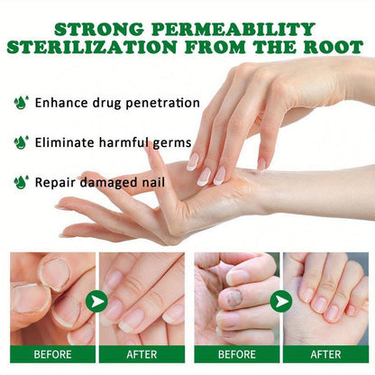 TRATAMENTO ANTI-FUNGOS 7 DIAS 100% NATURAL