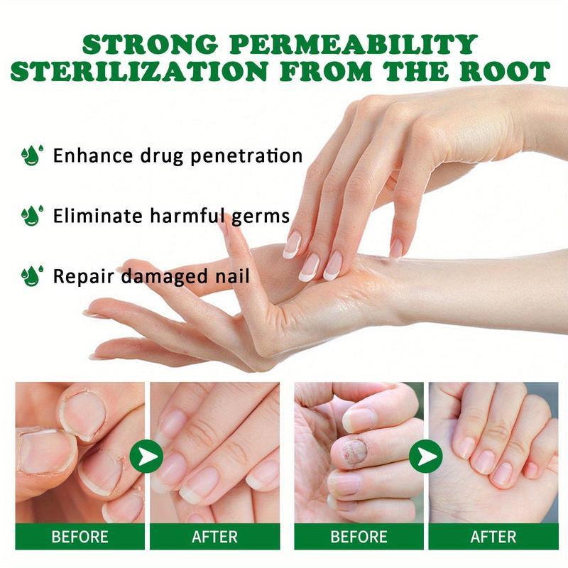 7 Days To Say GOODBYE to Ugly Nail Fungus! 👋