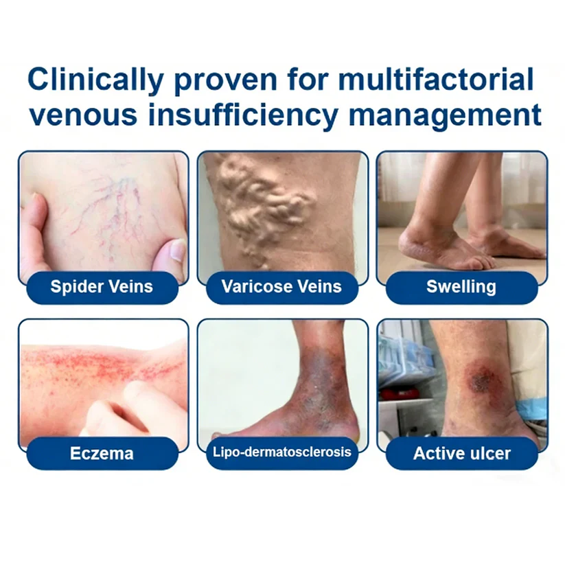 🇺🇸👨‍⚕️✅TAILEDEN® 𝑽𝗲𝗶𝙣 𝘾𝐨𝐧𝘁𝗼𝙪𝙧 𝙈𝙞𝐜𝐫𝒐𝒏𝒆𝗲𝗱𝗹𝙚 𝙋𝙖𝐭𝐜𝒉 𝒘𝒊𝘁𝗵 𝗔𝙙𝙫𝙖𝙣𝙘𝐞𝐝 𝐃𝒊𝒐𝒔𝗺𝙞𝐧 & 𝑯𝒆𝘀𝗽𝗲𝙧𝙞𝙙𝙞𝐧 𝐃𝒆𝒍𝒊𝒗𝗲𝗿𝙮🌿𝟕-𝐃𝐚𝐲 𝐕𝐢𝐬𝐢𝐛𝐥𝐞 𝐑𝐞𝐬𝐮𝐥𝐭𝐬 𝐟𝐨𝐫 𝐕𝐚𝐫𝐢𝐜𝐨𝐬𝐞 𝐕𝐞𝐢𝐧𝐬