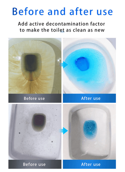⏰Last Day Surprise Price: 🔥SINK & DRAIN CLEANER