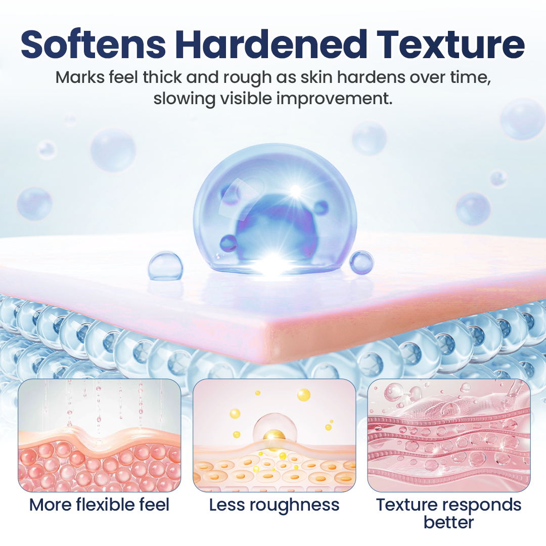 💥50% OFF💥Alisanda® Texture Repair Gel