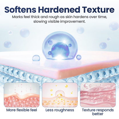 💥50% OFF💥Alisanda® Texture Repair Gel