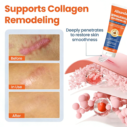 Alisanda® Dermal Rebuild Skin Repair & Restore Gel