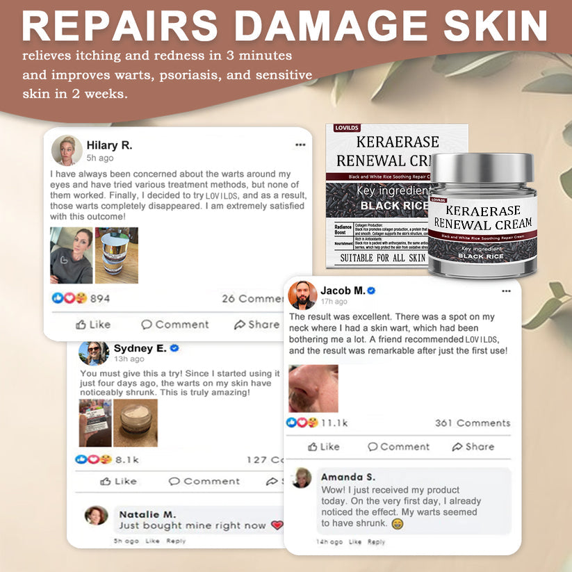 ✅Flash Sale - LOVILDS®KeraErase Dual-Action Renewal Cream