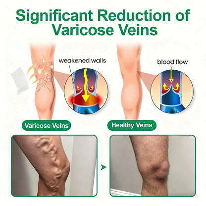 💧Alisanda® VeinTarget Microneedle Patch⚡Instant Relief, Long-Term Results