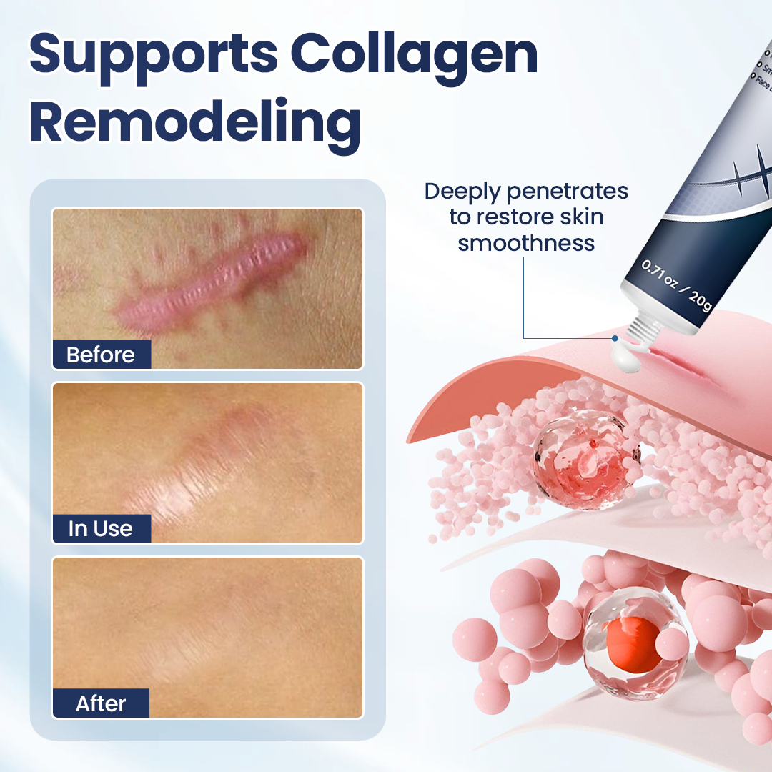 💥50% OFF💥Alisanda® Texture Repair Gel