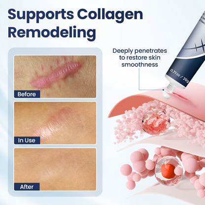 💥50% OFF💥Alisanda® Texture Repair Gel