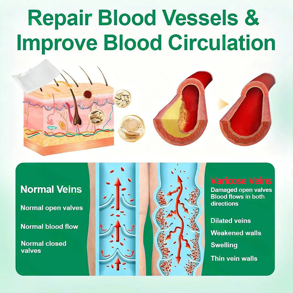 💧Alisanda® VeinTarget Microneedle Patch⚡Instant Relief, Long-Term Results