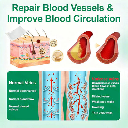💧Alisanda® VeinTarget Microneedle Patch⚡Instant Relief, Long-Term Results