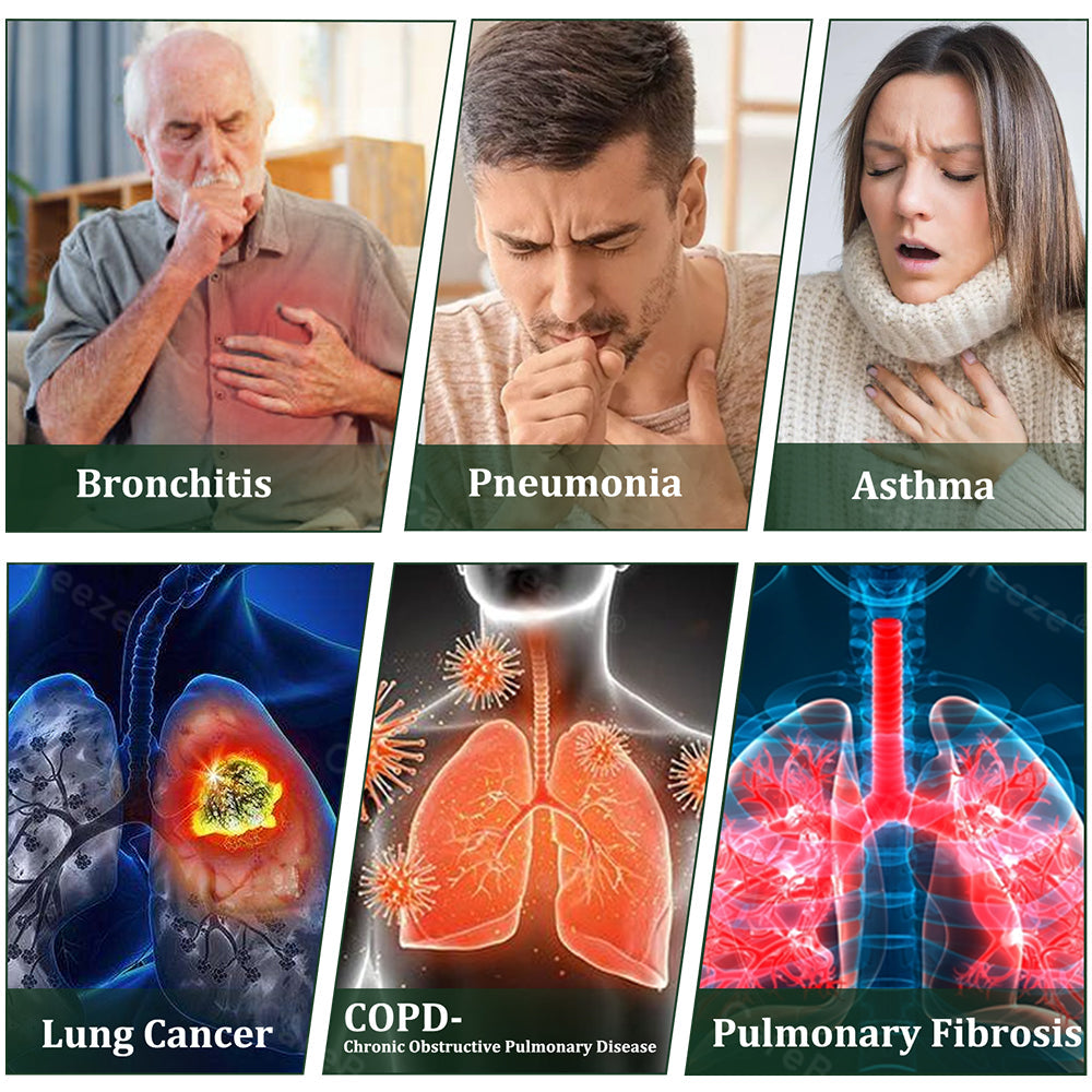 Alisanda® 6-in-1 Herbal BeePropolis Lung Cleanse Spray(⚡Fast Relief 🫁Long-Lasting Benefits)
