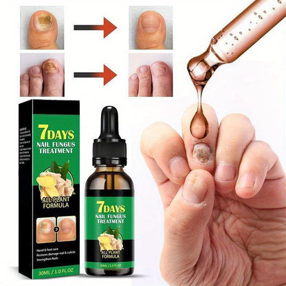 TRATAMENTO ANTI-FUNGOS 7 DIAS 100% NATURAL