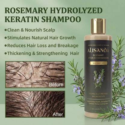 🔥LAST DAY 70% OFF🔥Alisanda® Rosemary Shampoo – Now Upgraded for Superior Hair Growth!