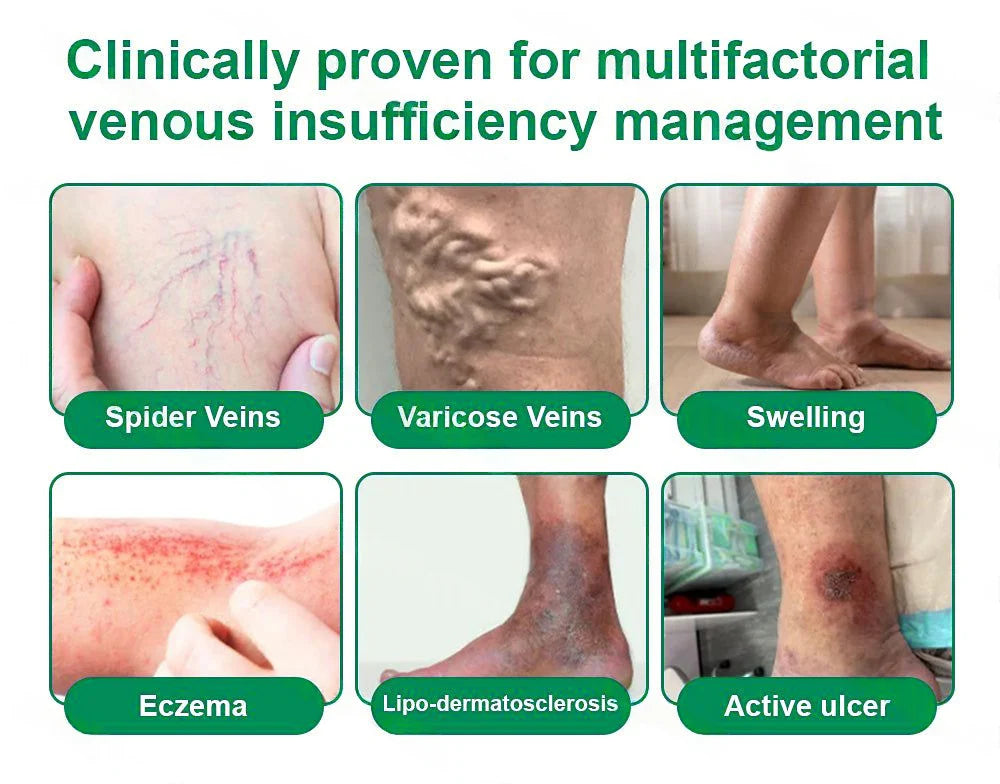 💧Alisanda® VeinTarget Microneedle Patch⚡Instant Relief, Long-Term Results