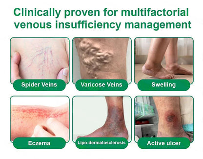 💧Alisanda® VeinTarget Microneedle Patch⚡Instant Relief, Long-Term Results