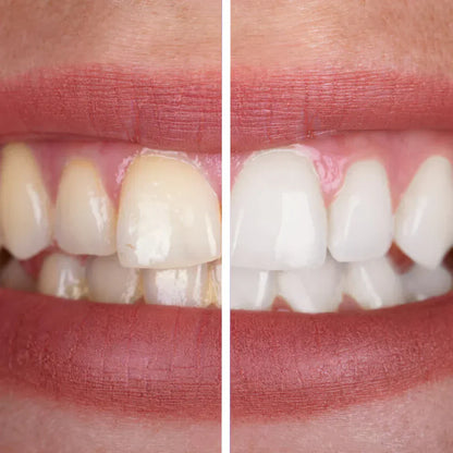 Alisanda® PurpleWhite Toothplaste