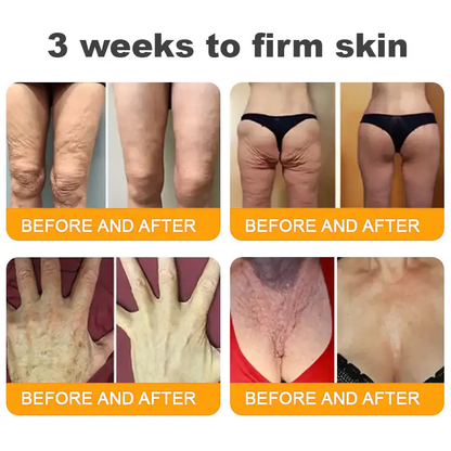 ✨LOVILDS™  Bee Venom Skin Restoration Cream — 🔥Limited Time 60% OFF🔥