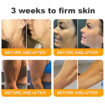 ✨LOVILDS™  Bee Venom Skin Restoration Cream — 🔥Limited Time 60% OFF🔥