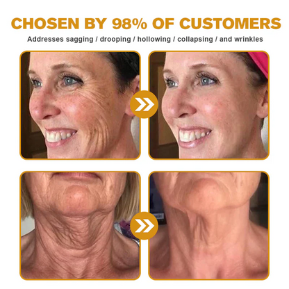 ✨LOVILDS™  Bee Venom Skin Restoration Cream — 🔥Limited Time 60% OFF🔥