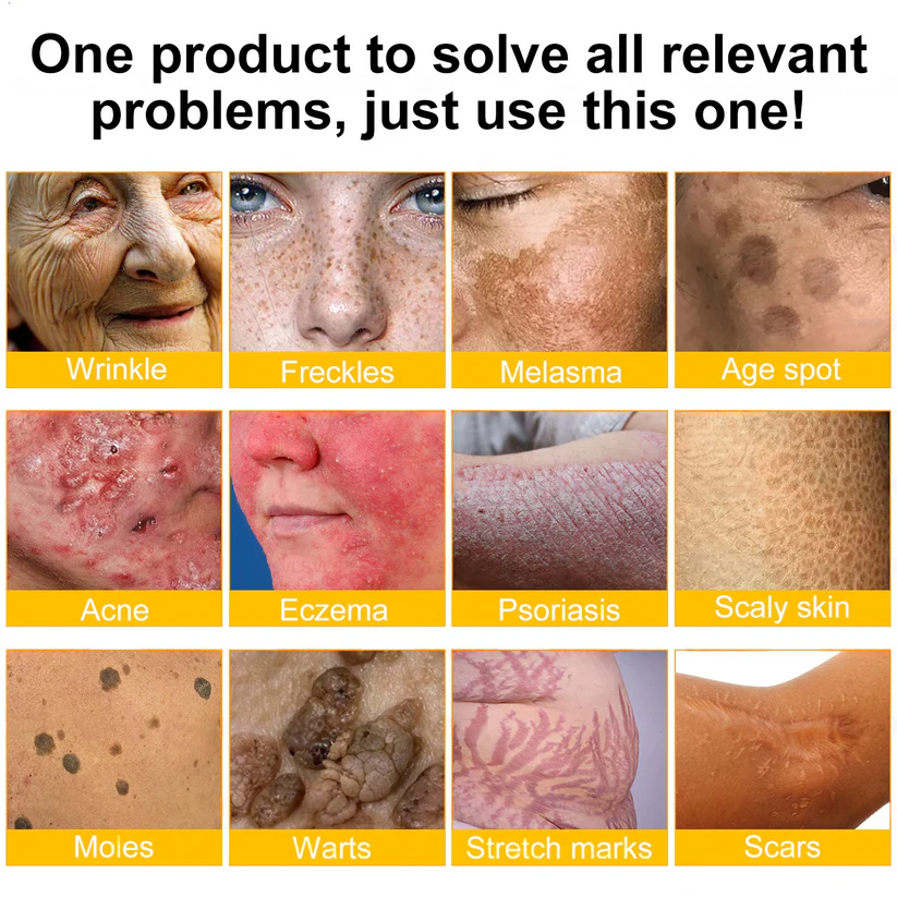 ✨LOVILDS™  Bee Venom Skin Restoration Cream — 🔥Limited Time 60% OFF🔥
