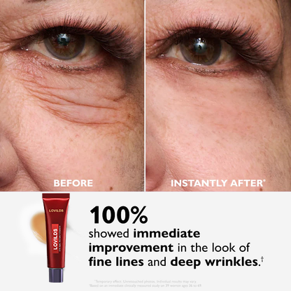 🔥 Last 3 Hours 50% OFF 🔥Eye Bag Eraser — Instantly Refreshes, Firms & Smooths for a Youthful Look That Lasts 8 Hours