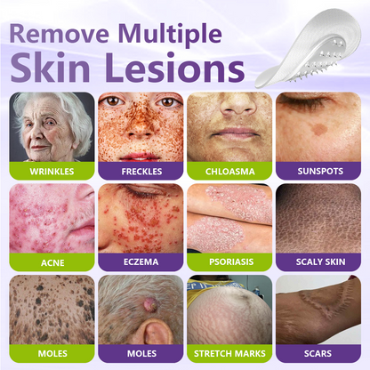 🔥🔥NESLEMY® Soluble Microneedle Botanical Skin Tag Removal Patch