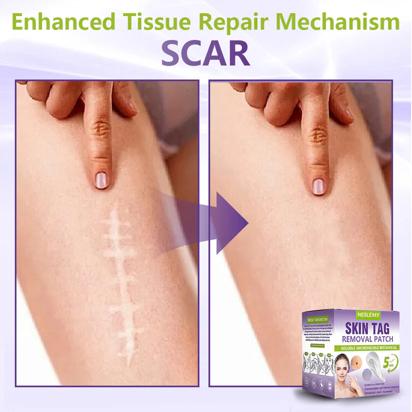 🔥🔥NESLEMY® Soluble Microneedle Botanical Skin Tag Removal Patch
