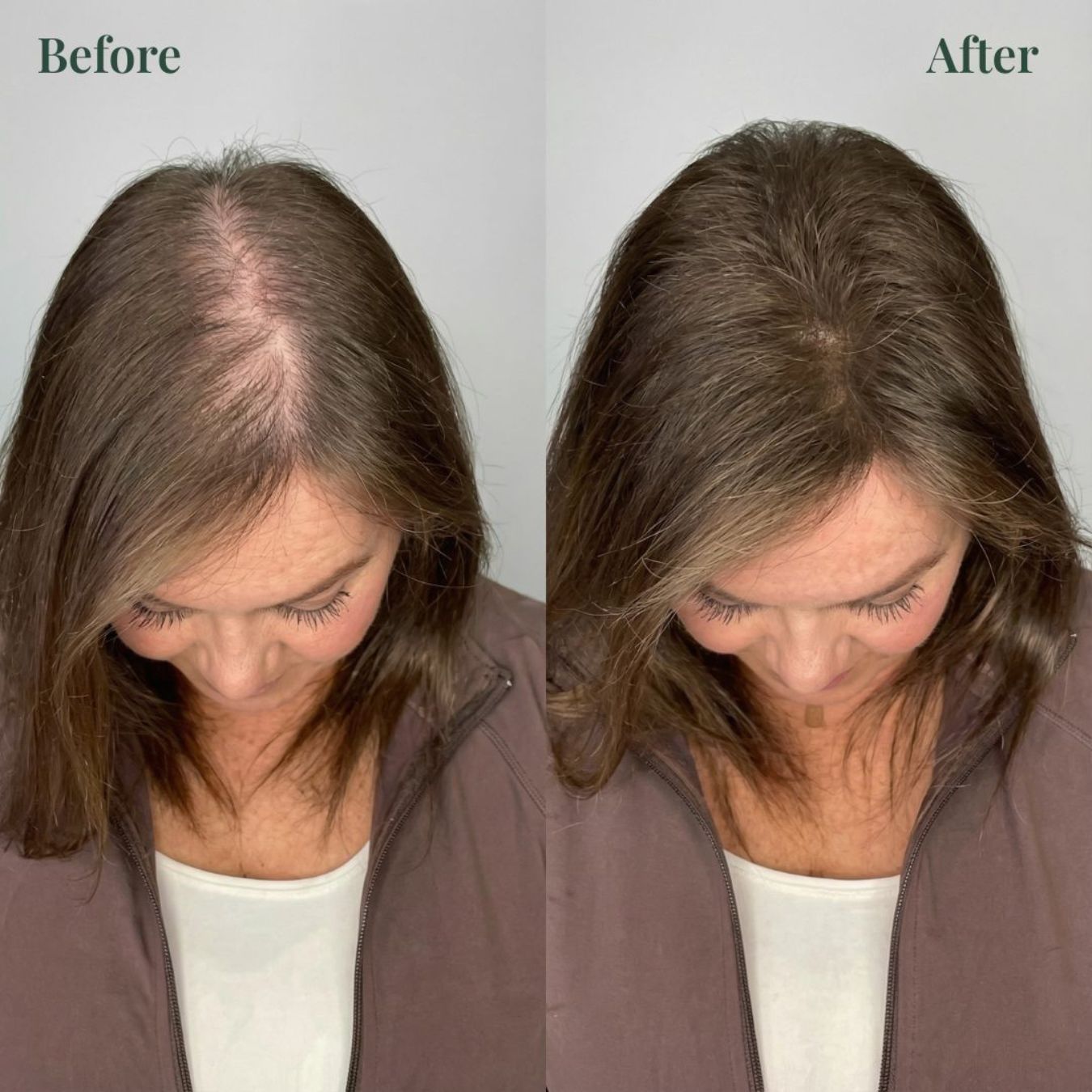 🔥LAST DAY 70% OFF🔥Alisanda® Rosemary Shampoo – Now Upgraded for Superior Hair Growth!